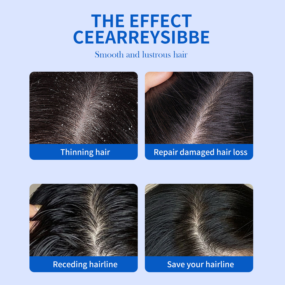 Shampoo Anticaspa com Dissulfe - Hair Care Dandruff avaliação e preço