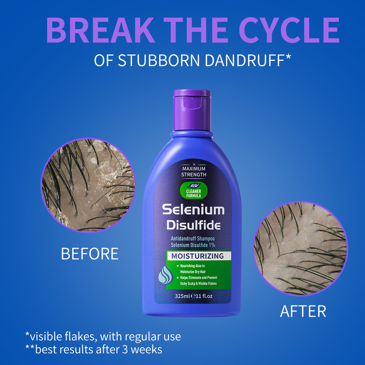 Shampoo Anticaspa com Dissulfe - Hair Care Dandruff avaliação e preço